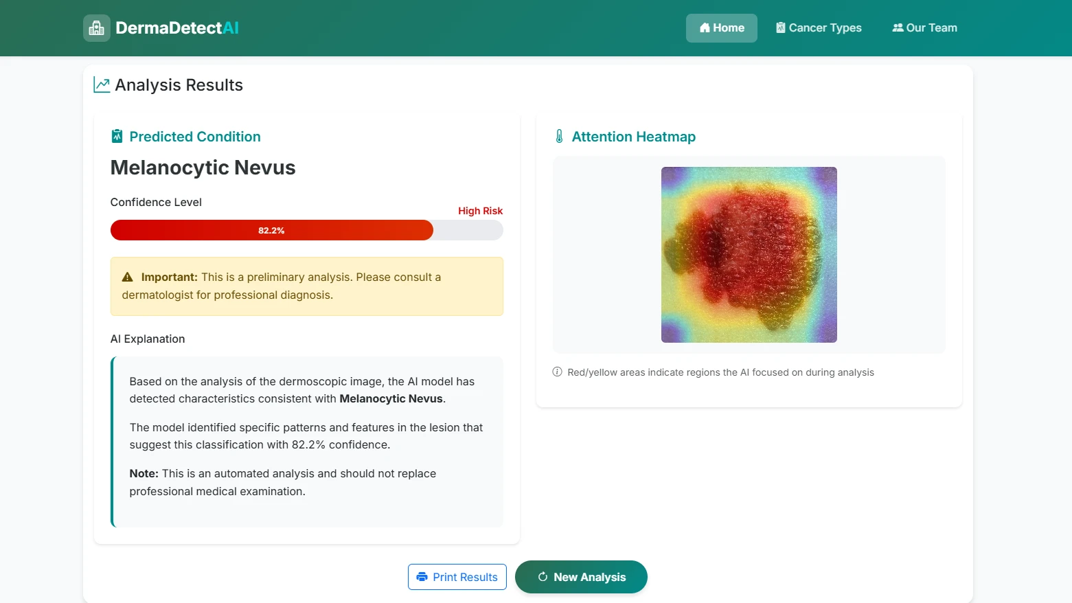 Skin lesion classification result with Grad-CAM visualization