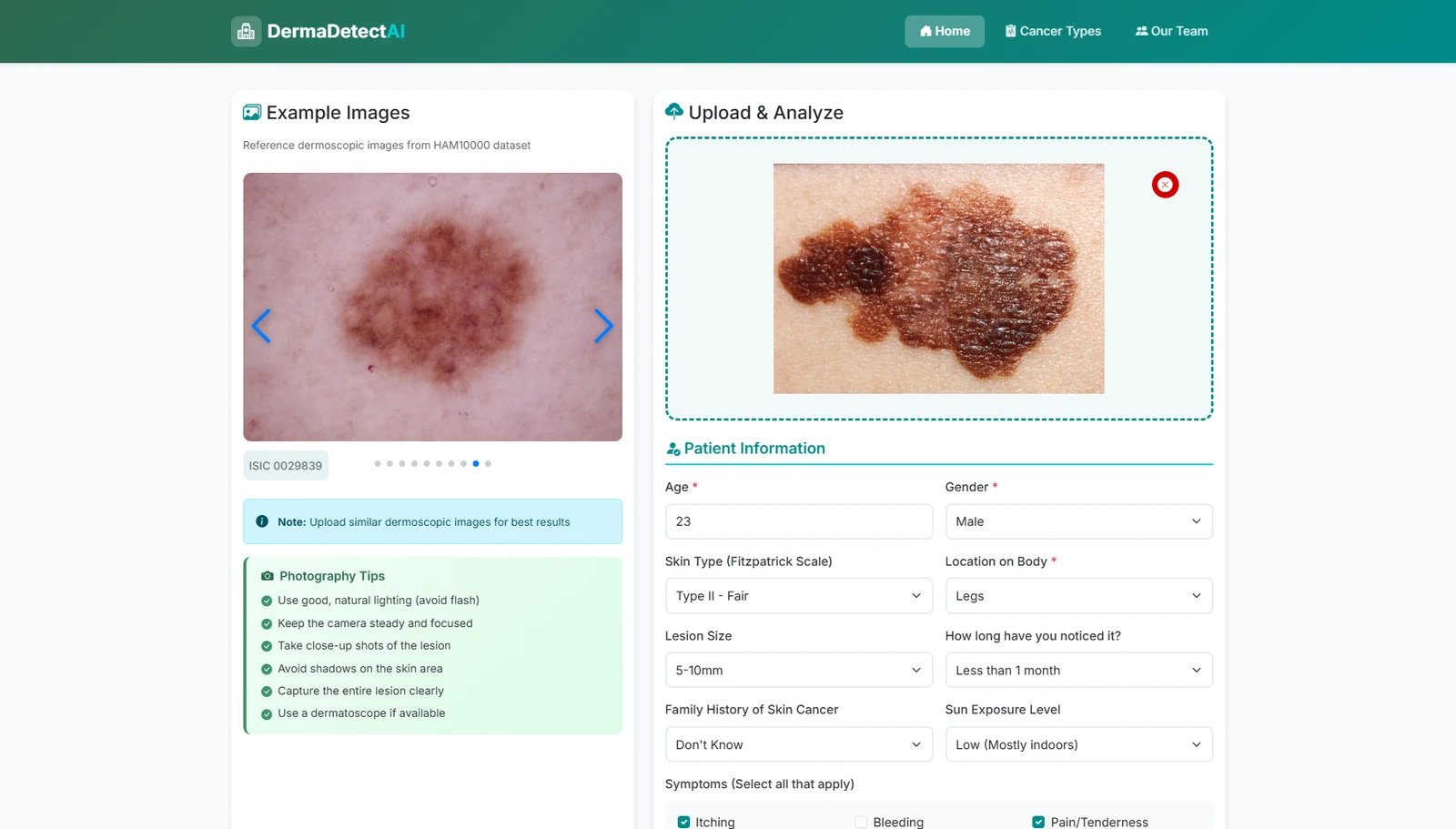 Skin lesion classification image upload interface